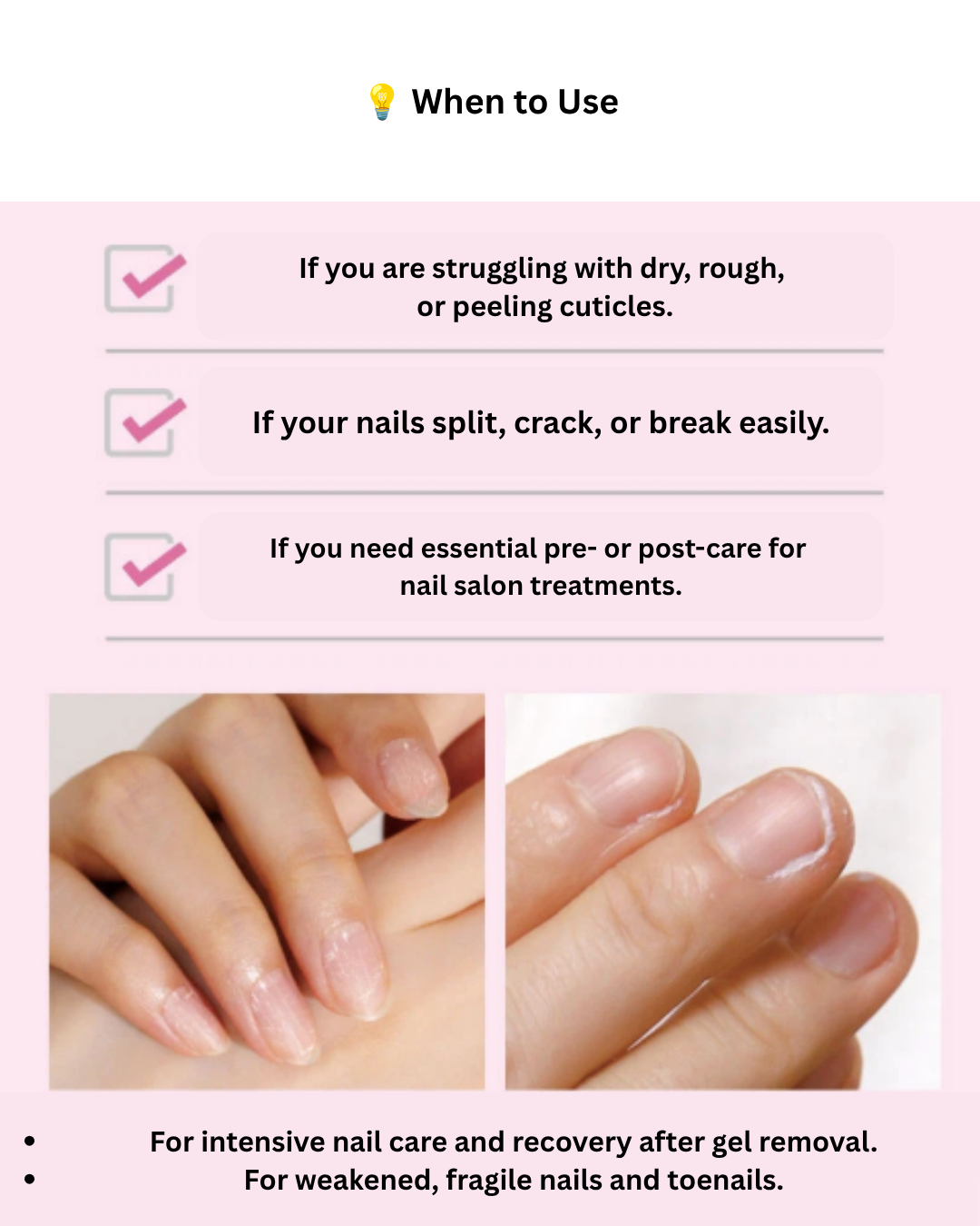 💅 RingRing Nail Dia Repair Pink Serum 30ml