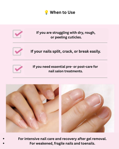 💅 RingRing Nail Dia Repair Pink Serum 30ml