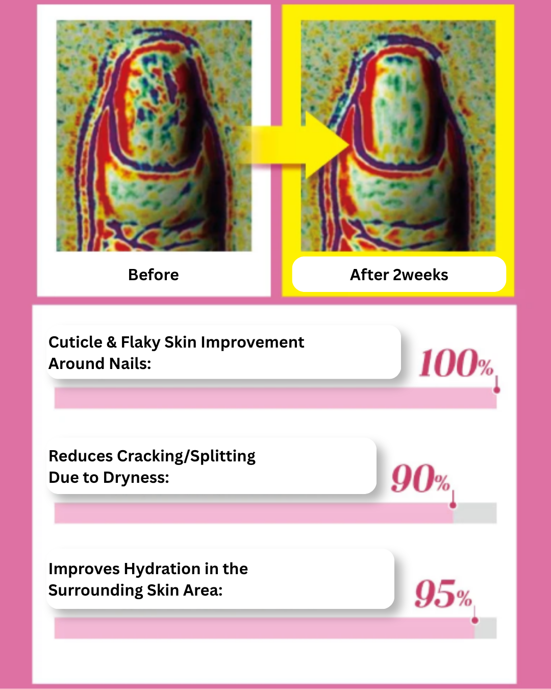 💅 RingRing Nail Dia Repair Pink Serum 30ml