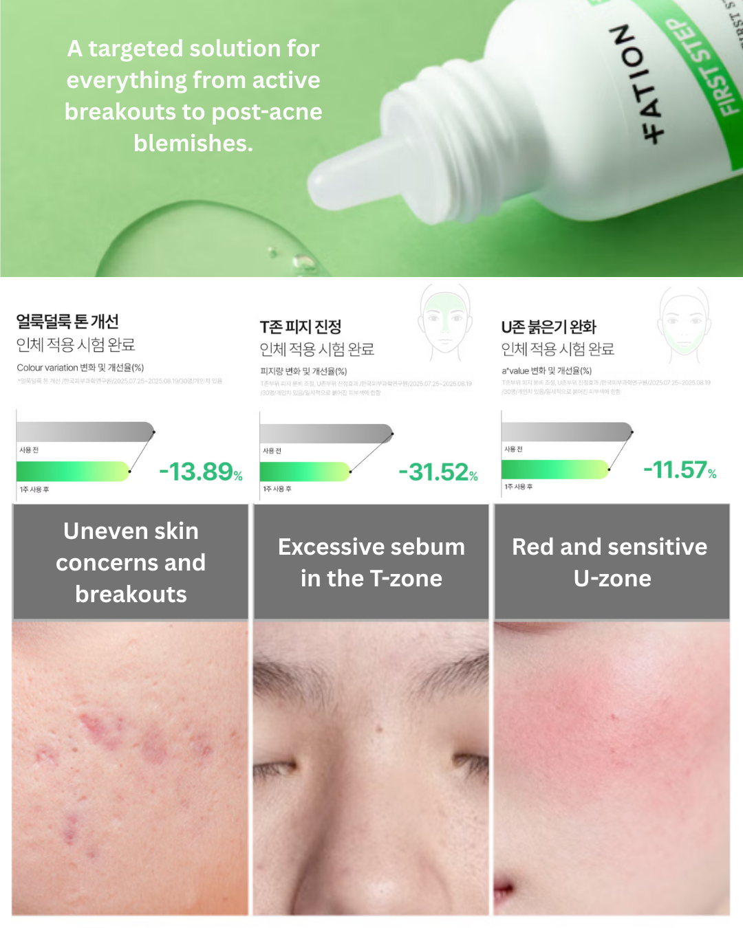 🌱Nosca9 First Step Clear Blemish Ampoule (30ml)