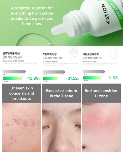 🌱Nosca9 First Step Clear Blemish Ampoule (30ml)
