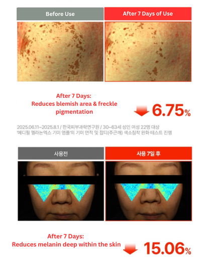 🌻MELANON X Blemish Ampoule 30ml