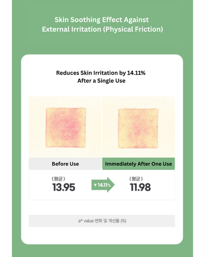 💦CURE Intensive 2X Cream (30g)